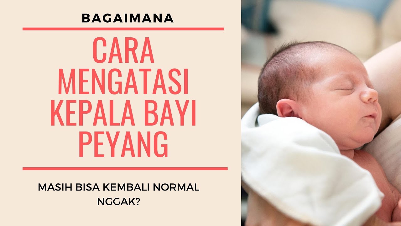 Cara Mengatasi Kepala Bayi Peyang