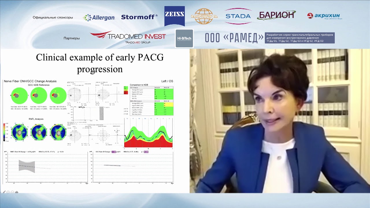 The special features of optic neuropathy and its progression in PACG.