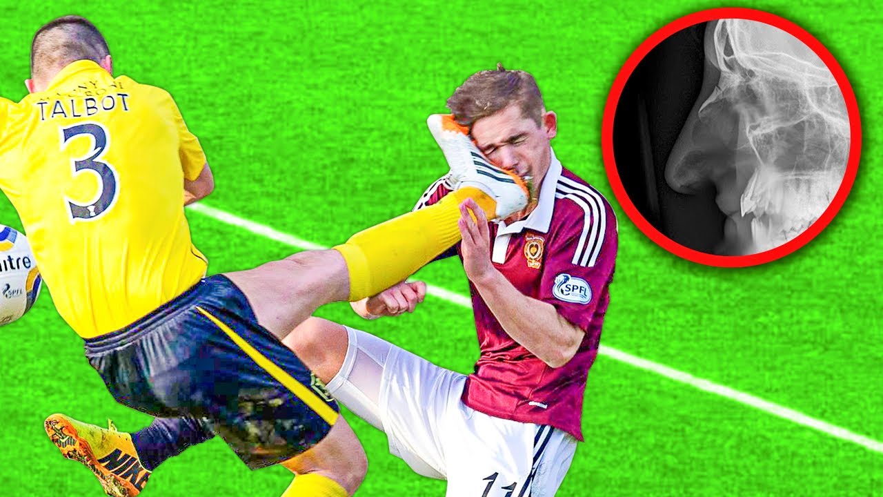 Most SHOCKING Fouls in Football