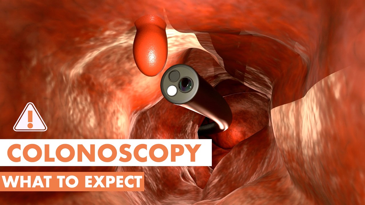 Co się dzieje podczas kolonoskopii? | Animacja 3D
