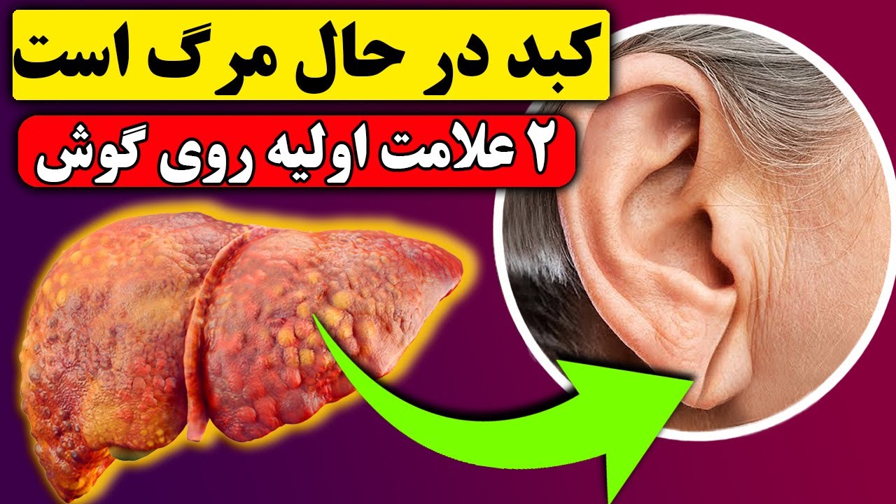 کبد در حال مرگ است !‌ ۱۰ نشانه عجیب آسیب کبدی روی صورت و گوش | زودتر آگاه شوید + درمان