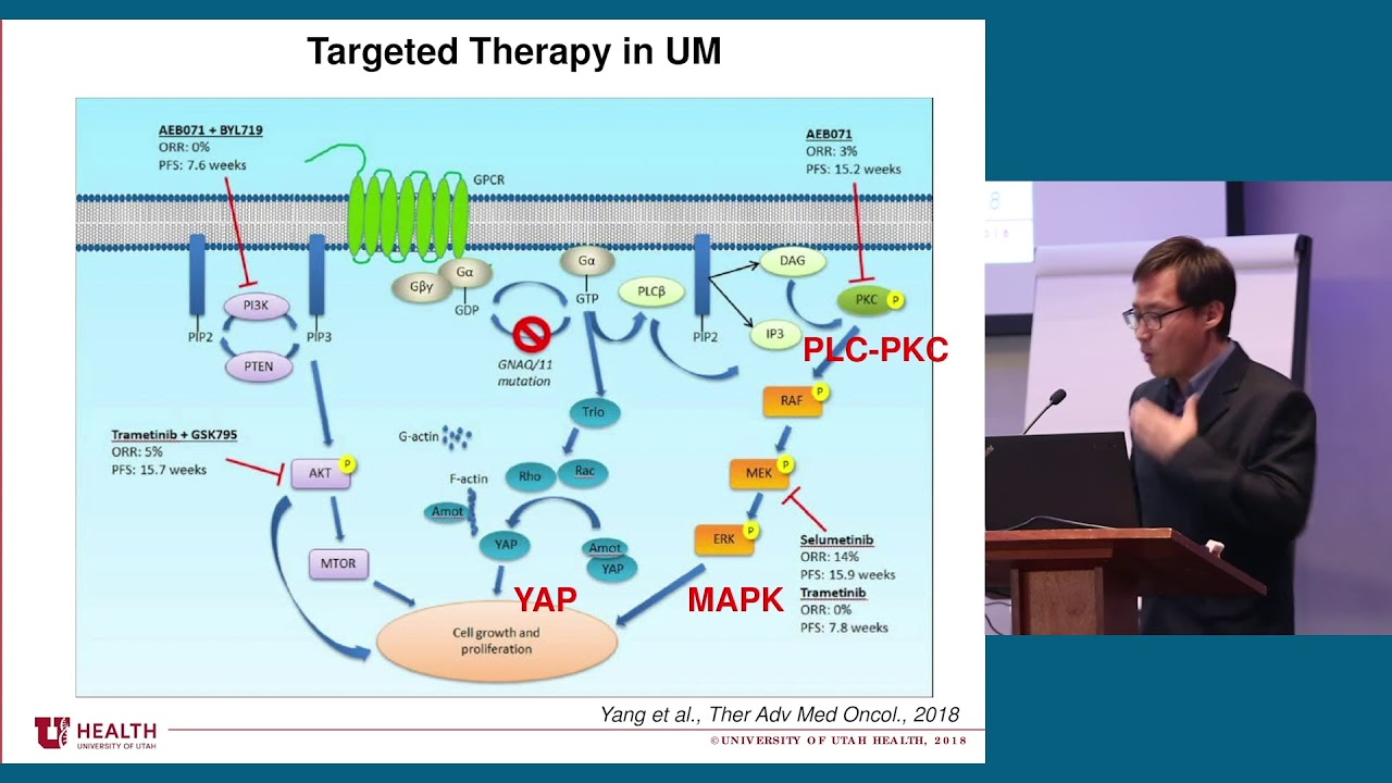 A Potential Molecular Target for the Treatment of Uveal Melanoma
