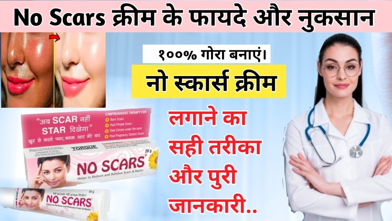 No Scars Cream | No Scars Cream Use Karne Ka Tarika | no scars cream side-effects In Hindi| Melasma