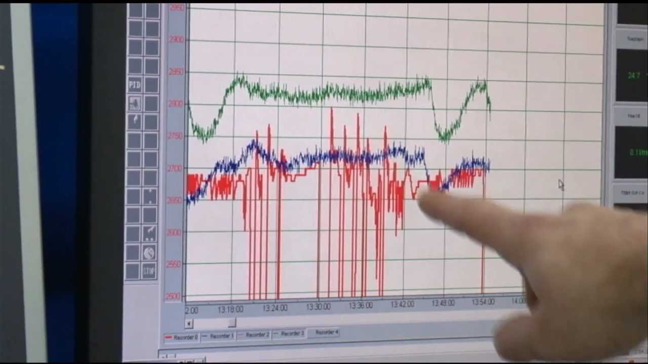 The Work of a Laser Technician