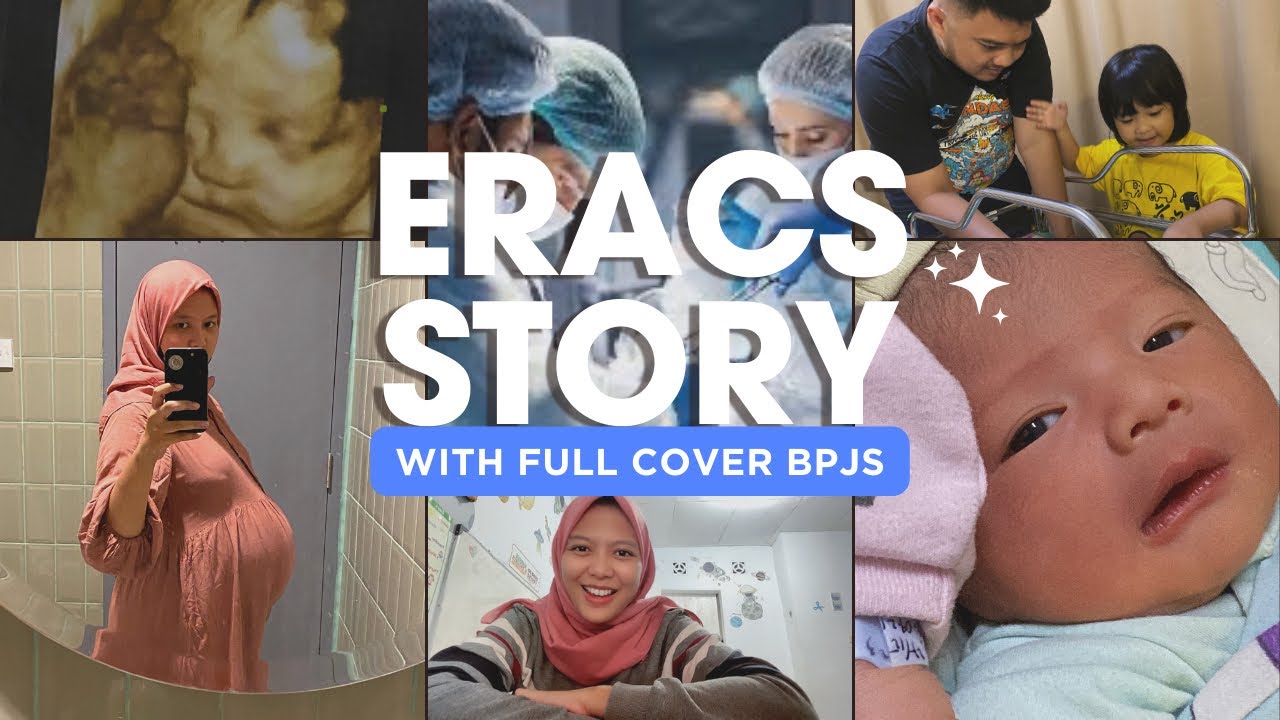 MELAHIRKAN DENGAN OPERASI METODE ERACS - FULL COVER BPJS