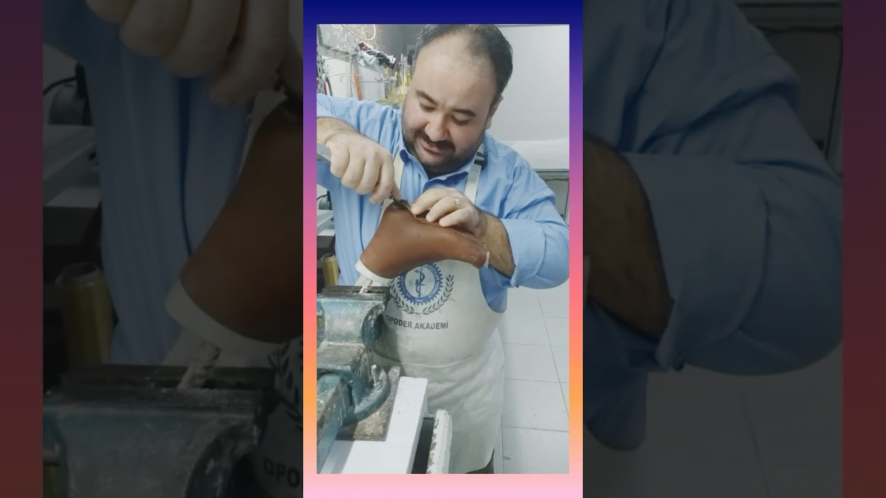 uzun yürüme ortezi yapımı...