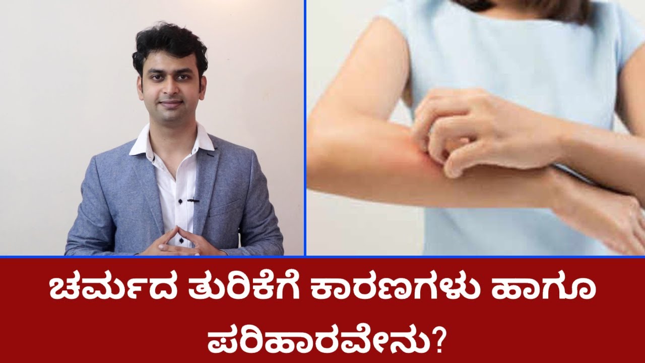 Itchy Skin- Causes And Ayurvedic Remedies | Vijay Karnataka