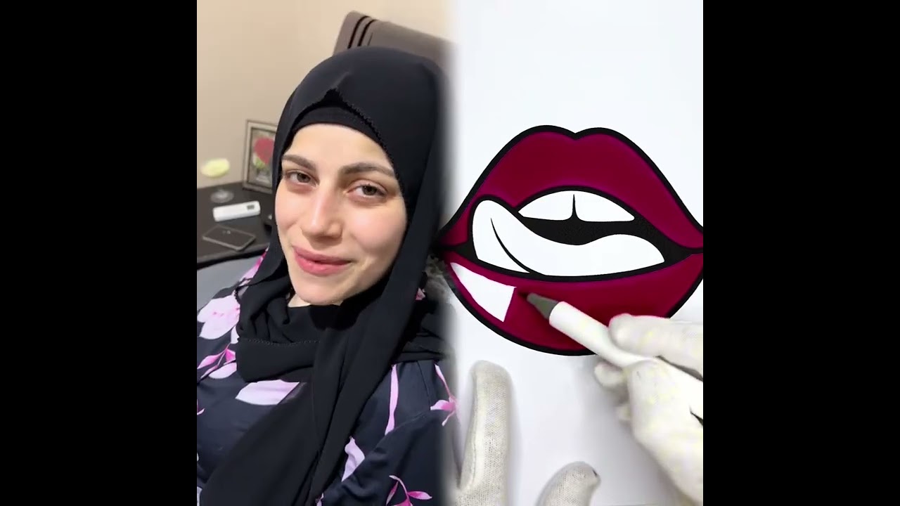 #الطفل الاعمى المعجزه #محضوره_من_الاكسبلور_والمشاهدات #علاوي_مارتن #اكسبلور 15_w