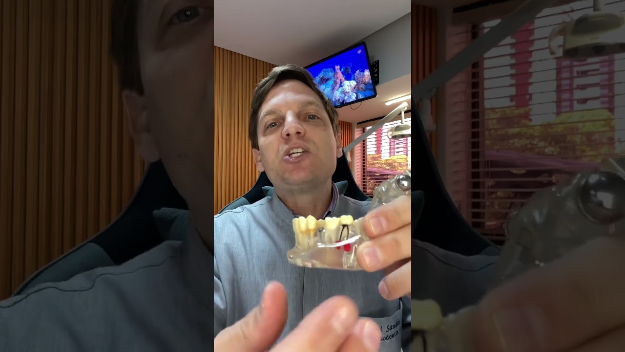 Implante imediato e carga imediata