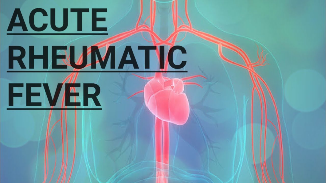 CARDIOVASCULAR SYSTEM - ACUTE RHEUMATIC FEVER