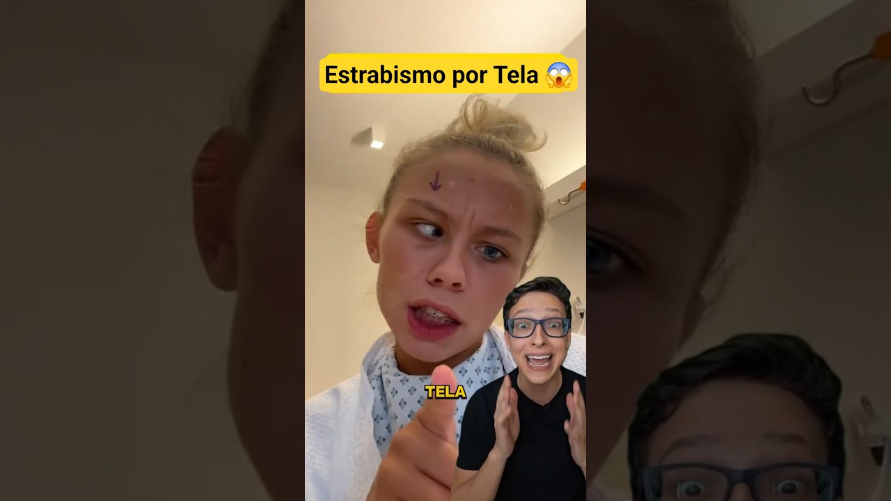 Celular causa Estrabismo? 😱