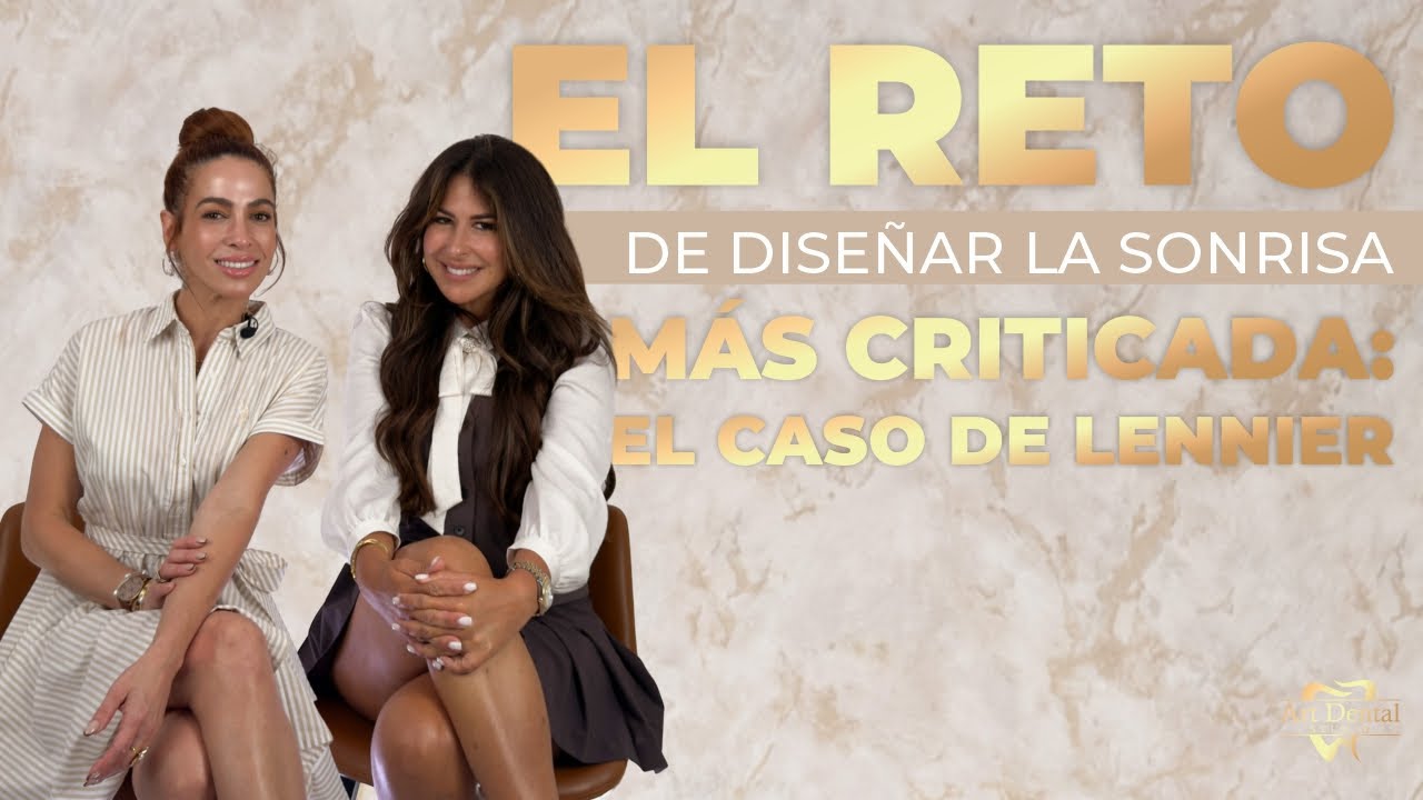 El reto de diseñar LA SONRISA MÁS CRÍTICADA - El caso de Lennier