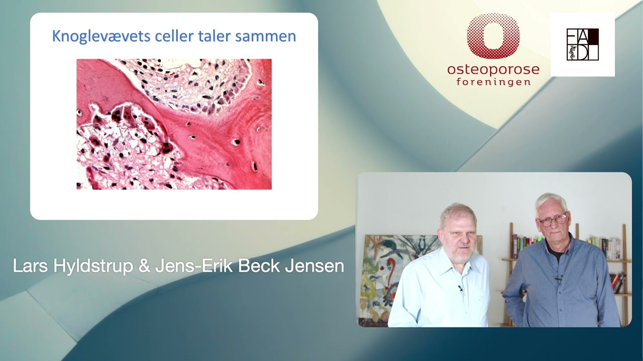 Hvordan lever jeg knoglesundt og bør jeg overveje at blive undersøgt for osteoporose?