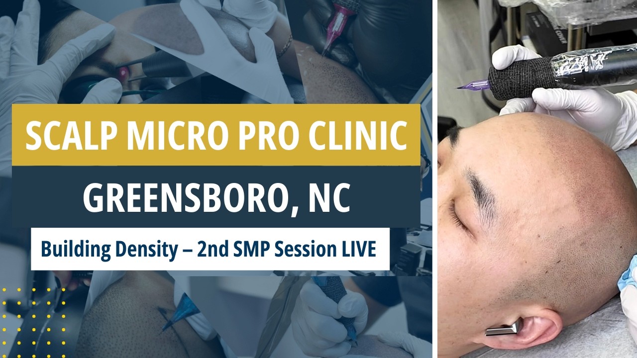 Live Scalp Micropigmentation | Second Session