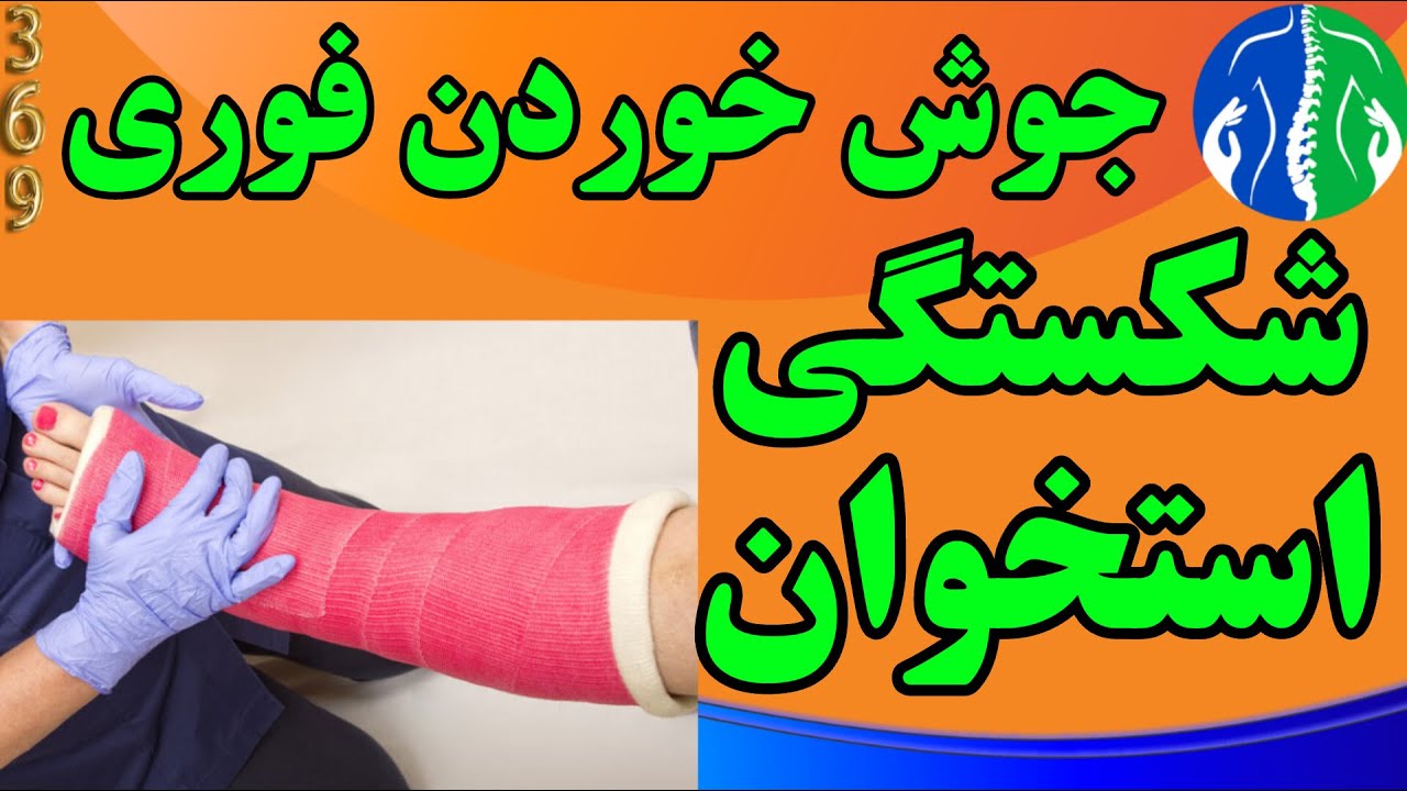 شکستگی استخوان: نسخه معجزه آسای جوش خوردن فوری شکستگی استخوان| استخوان سازی