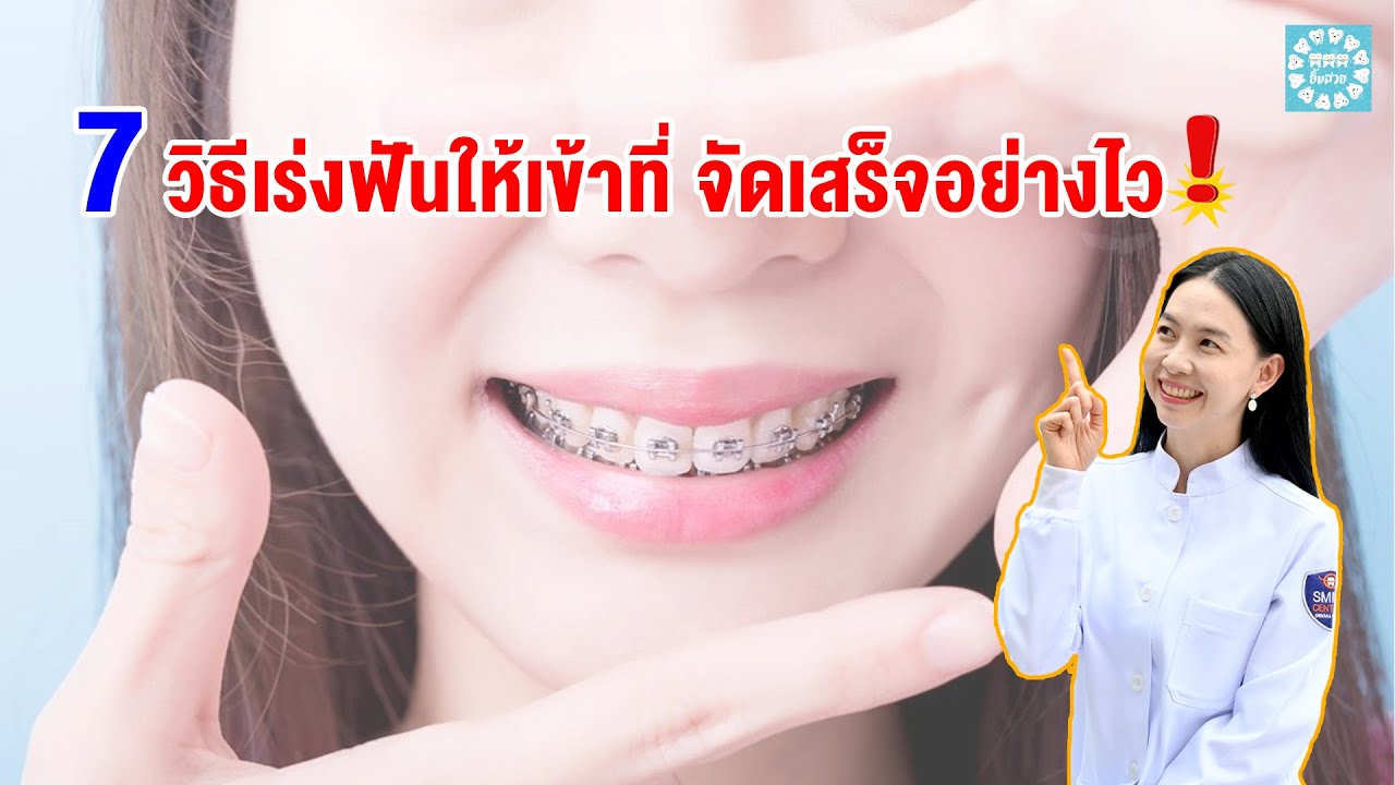 7 วิธีเร่งฟันให้เข้าที่ จัดเสร็จอย่างไว!!