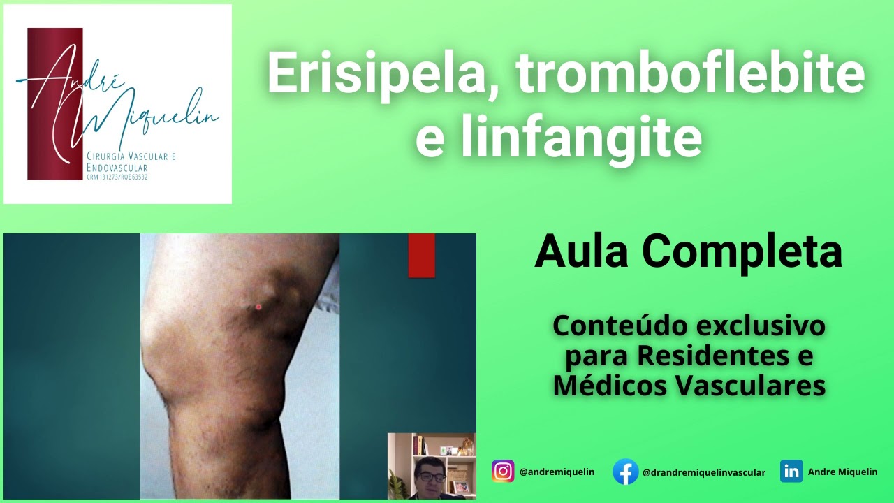 Erisipela, tromboflebite e linfangite