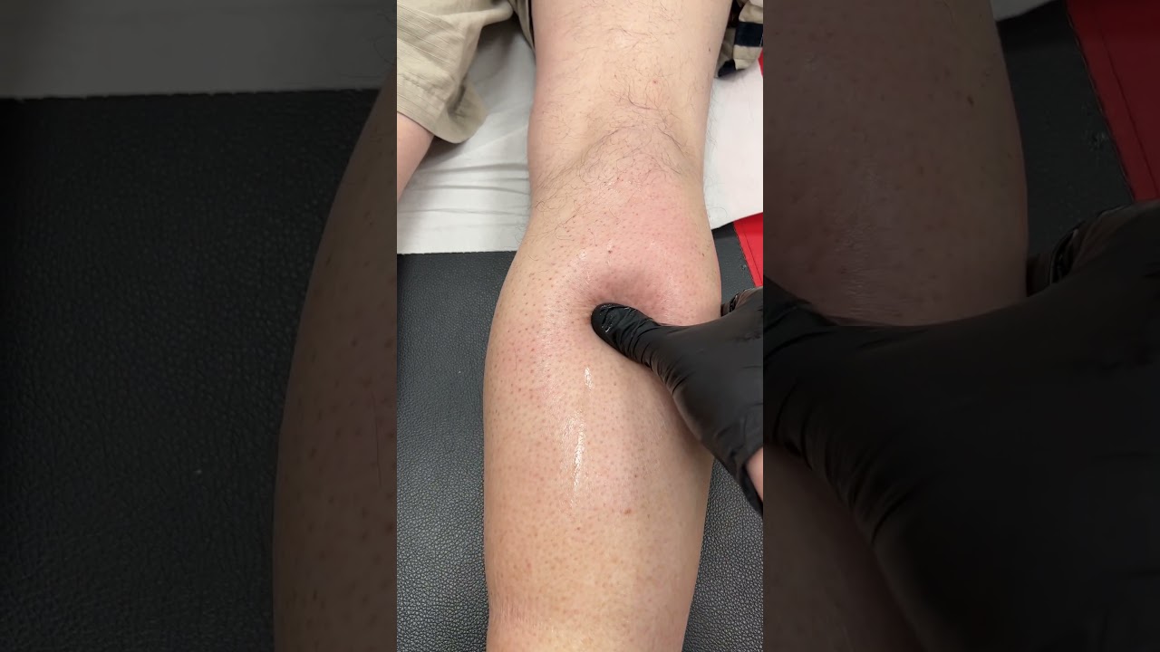 DEEP TISSUE MASSAGE CALF PAIN