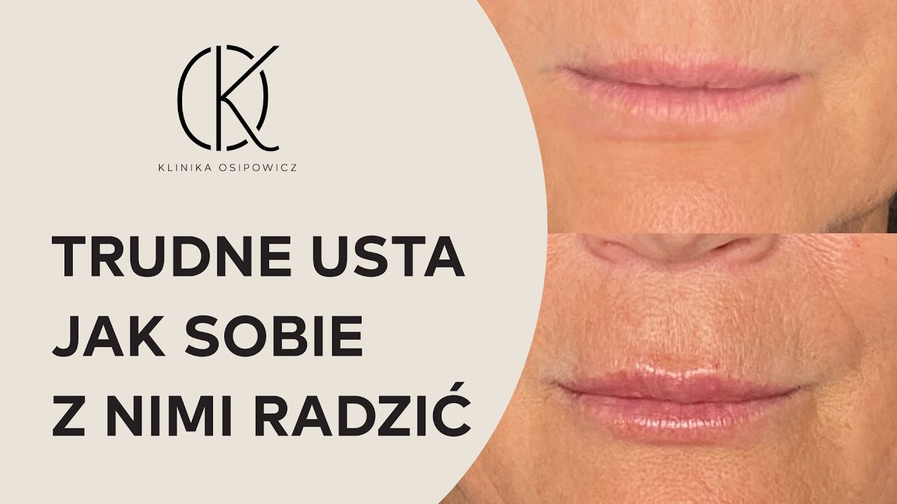 Trudne Usta - Jak sobie z Nimi Radzić? Najczęstsze Pytania