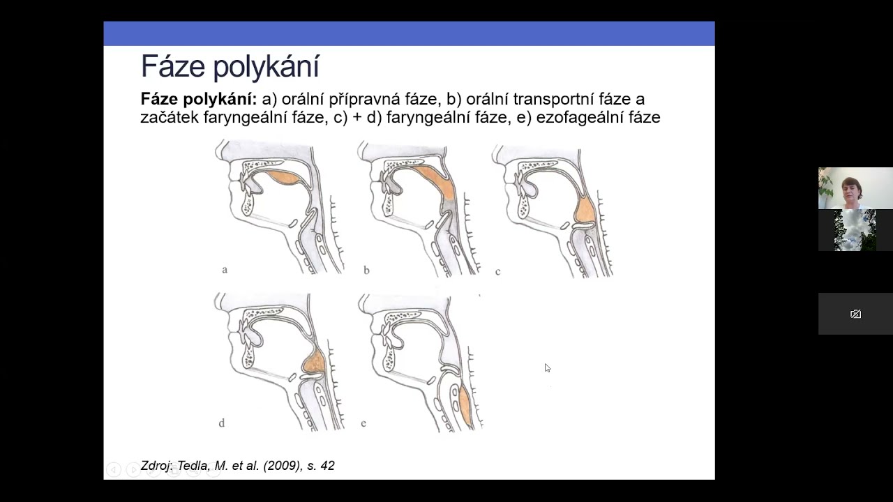 Logopedická intervence u starších pacientů s poruchami polykání