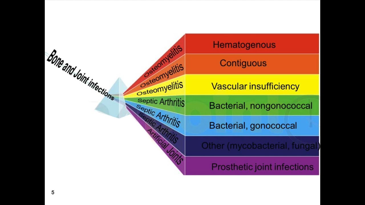 Overview of Bone and Joint Infections - Yanina Pasikhova, PharmD