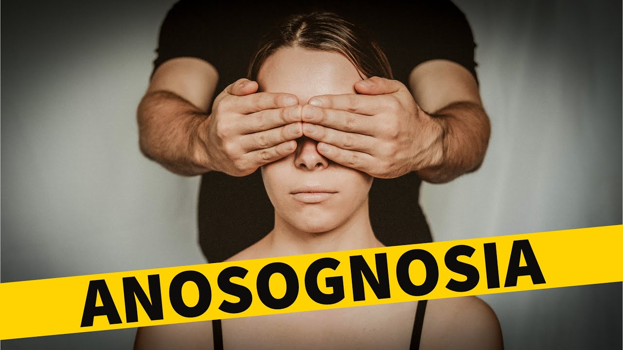 ANOSOGNOSIA:  Signs, Symptoms, Causes (Bipolar Disorder & Denial)
