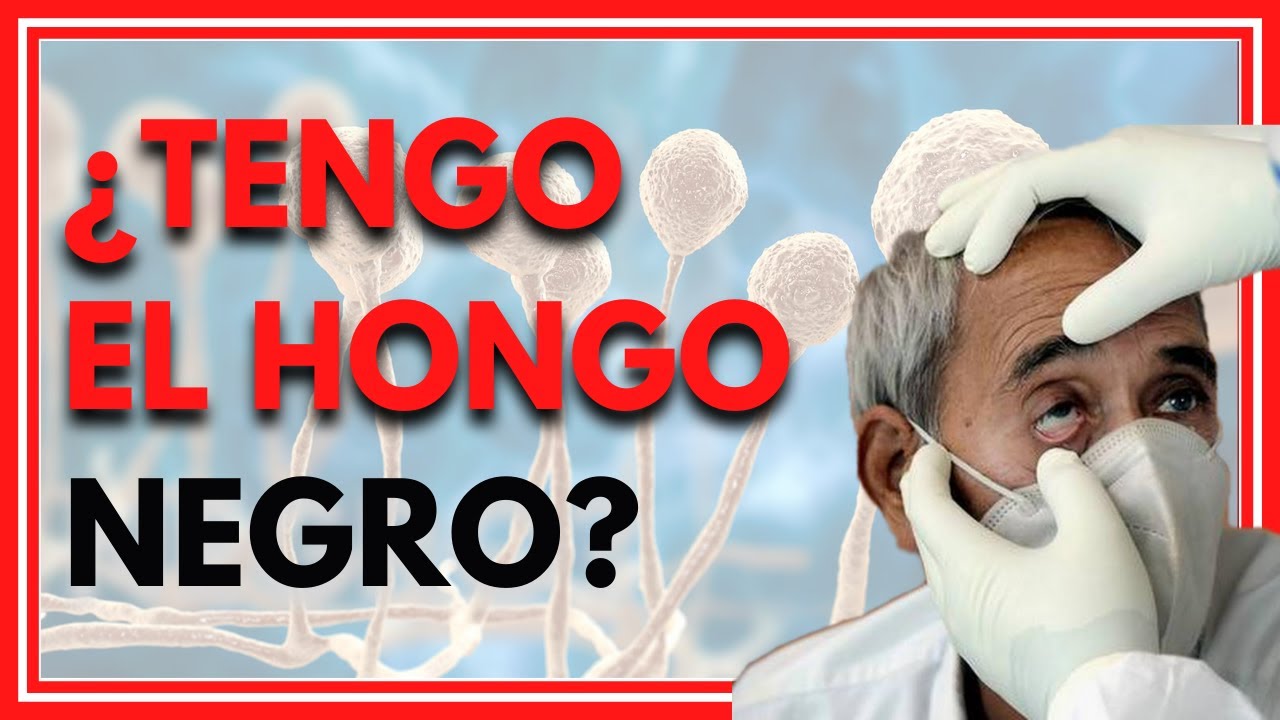 Te explico qué es el HONGO NEGRO, sus SINTOMAS y como se relaciona con el COVID