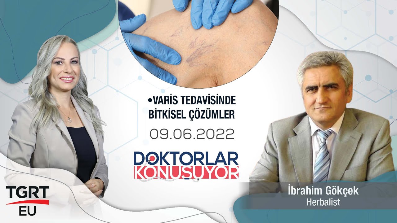 Varis Nedir, Belirtileri ve Tedavi Yöntemleri Nelerdir? - Doktorlar Konuşuyor