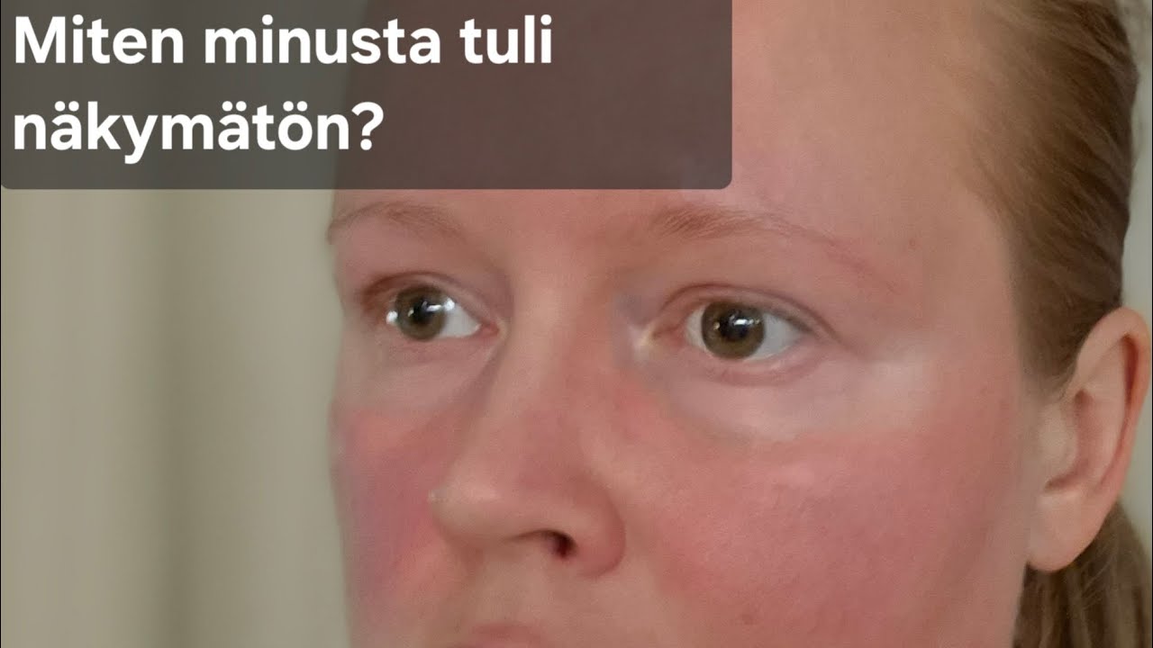 Tunsin muuttuneeni näkymättömäksi… — yksi oivallus muutti jotain
