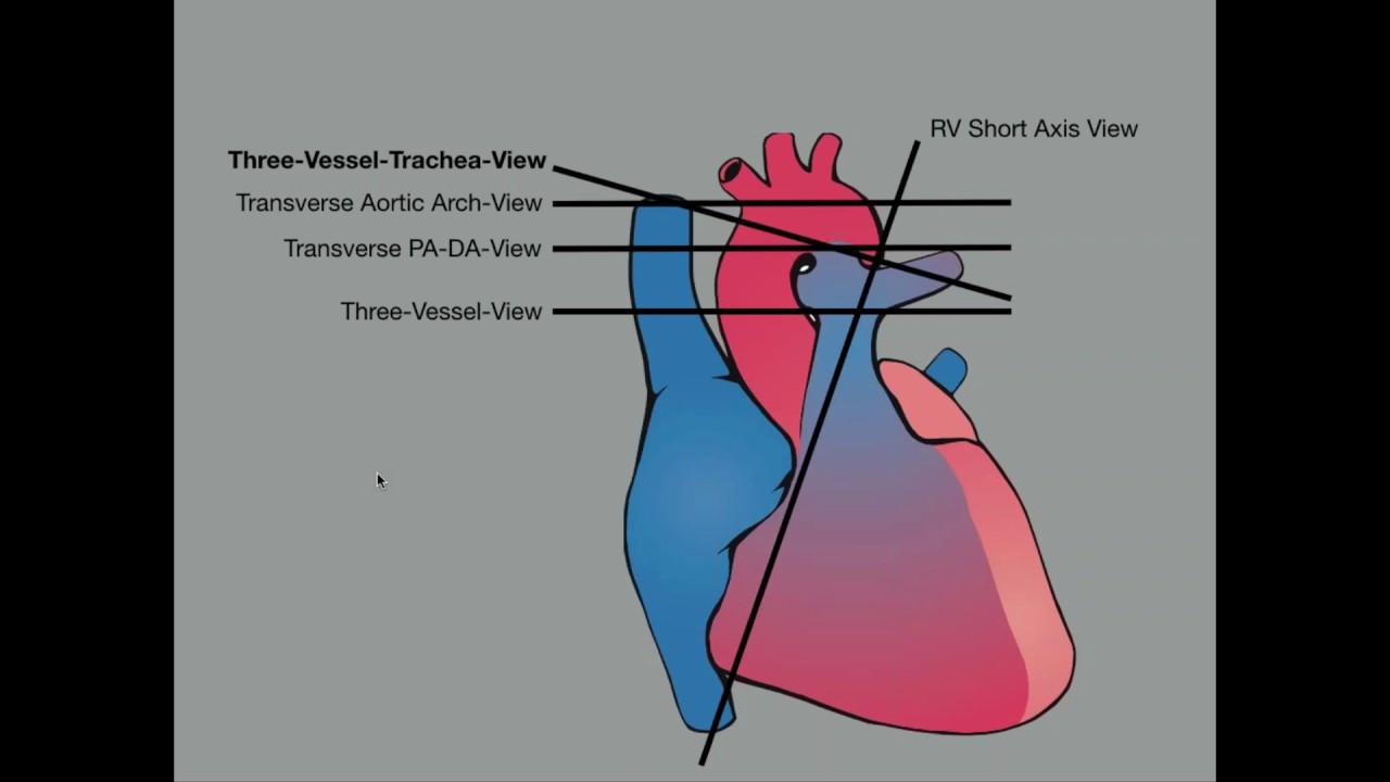 Advanced Evaluation of the Fetal Heart