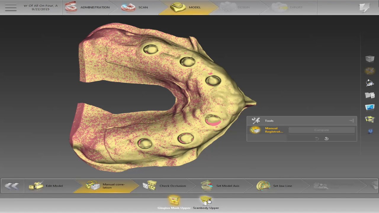 On-Demand Webinar: Harvest TriLor® Screw-retained Full Arch Step-by-step with Frankie Acosta