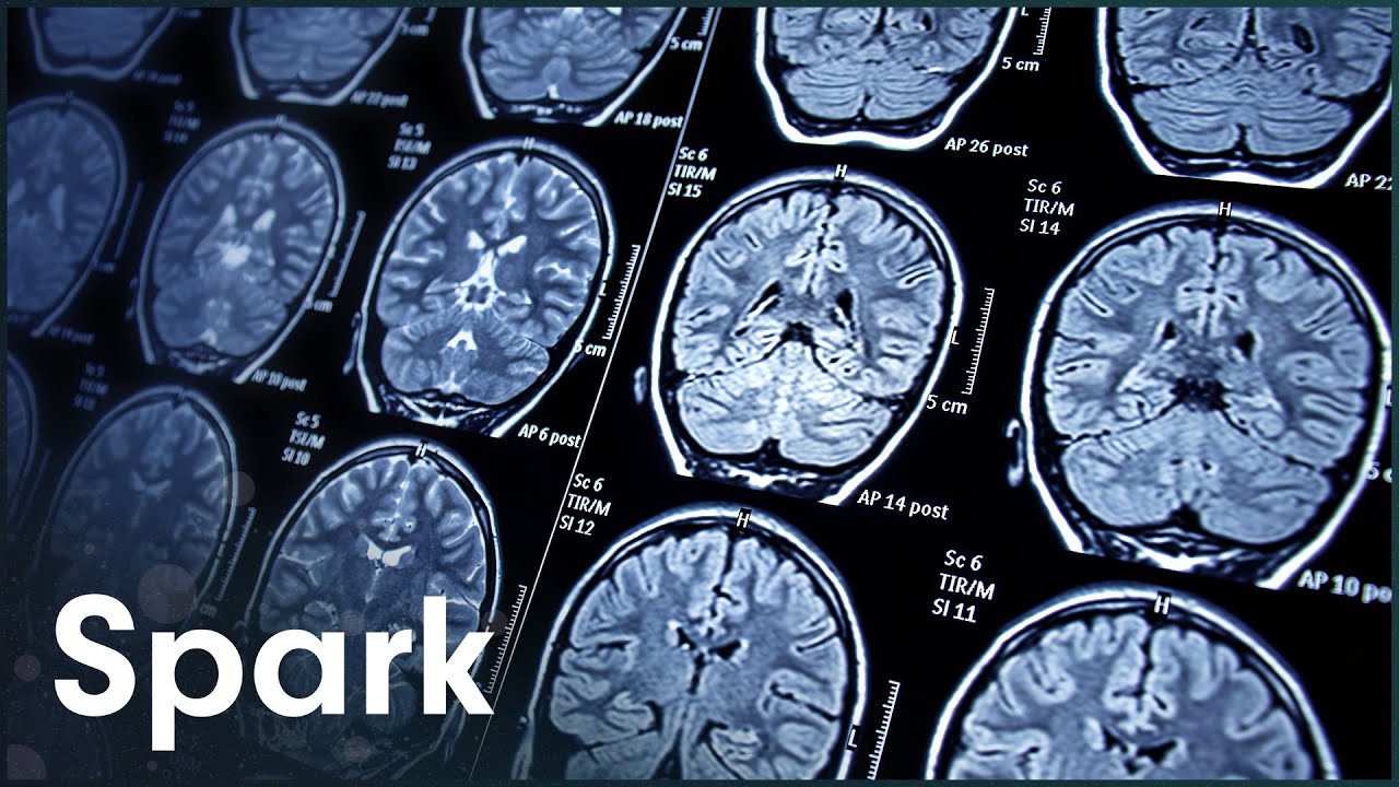 What Happens To The Brain In Old Age?