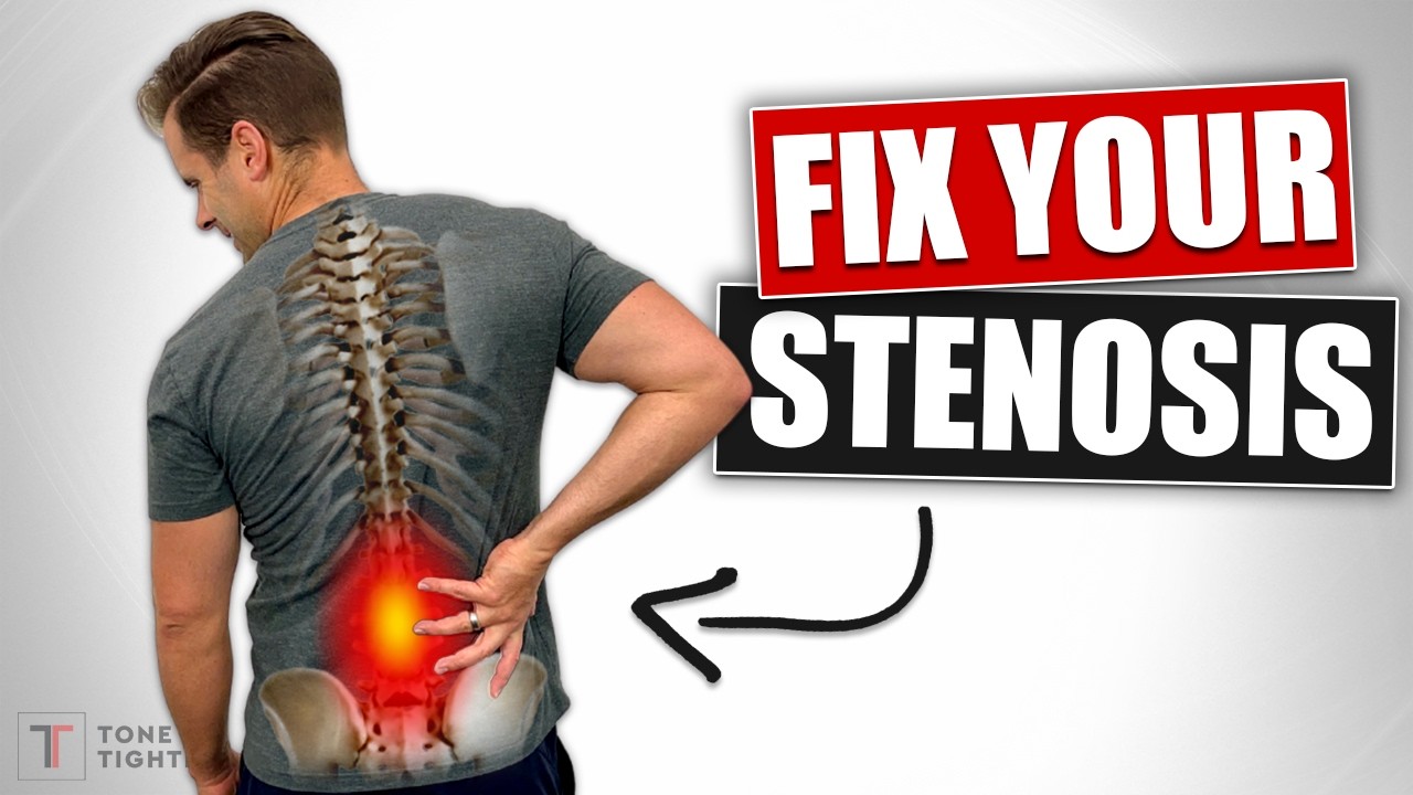 Fix Lower Back Stenosis And Sciatica! [Home Exercises For DDD And Arthritis]