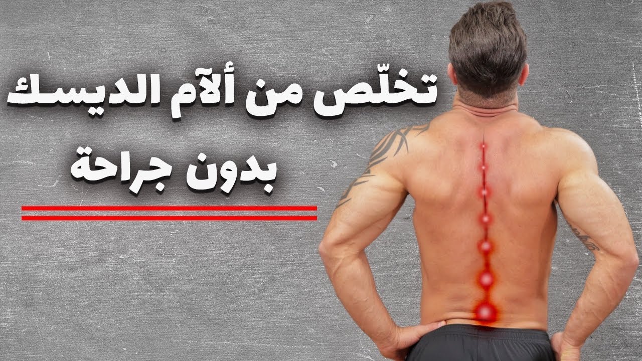 عالج الديسك وتخلص من الامه بدون جراحة