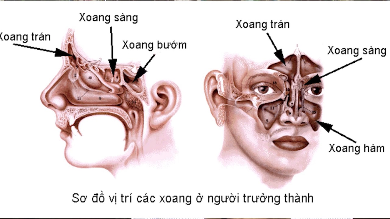 (VTC14)_ Bài thuốc dân gian điều trị bệnh viêm xoang