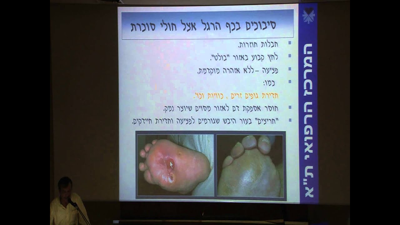 עקב אכילס