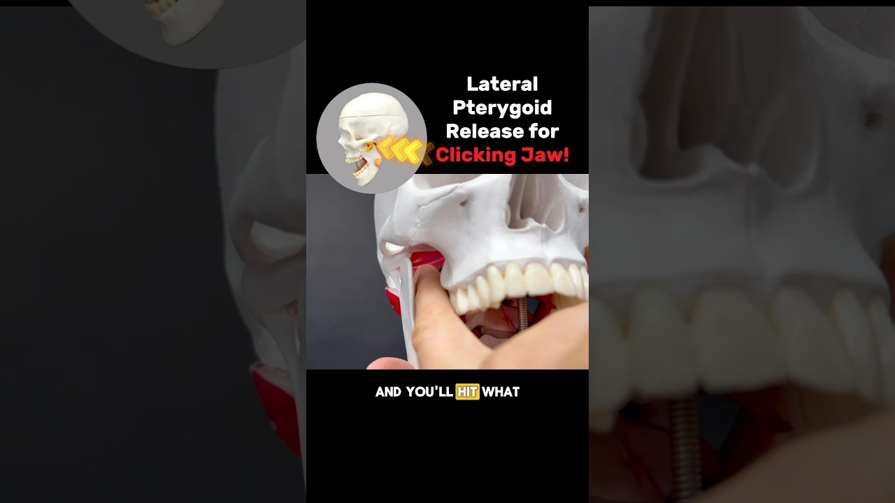 Clicking popping Jaw? Try this Lateral Pterygoid Release! #tmj #tmd #tmjtreatment