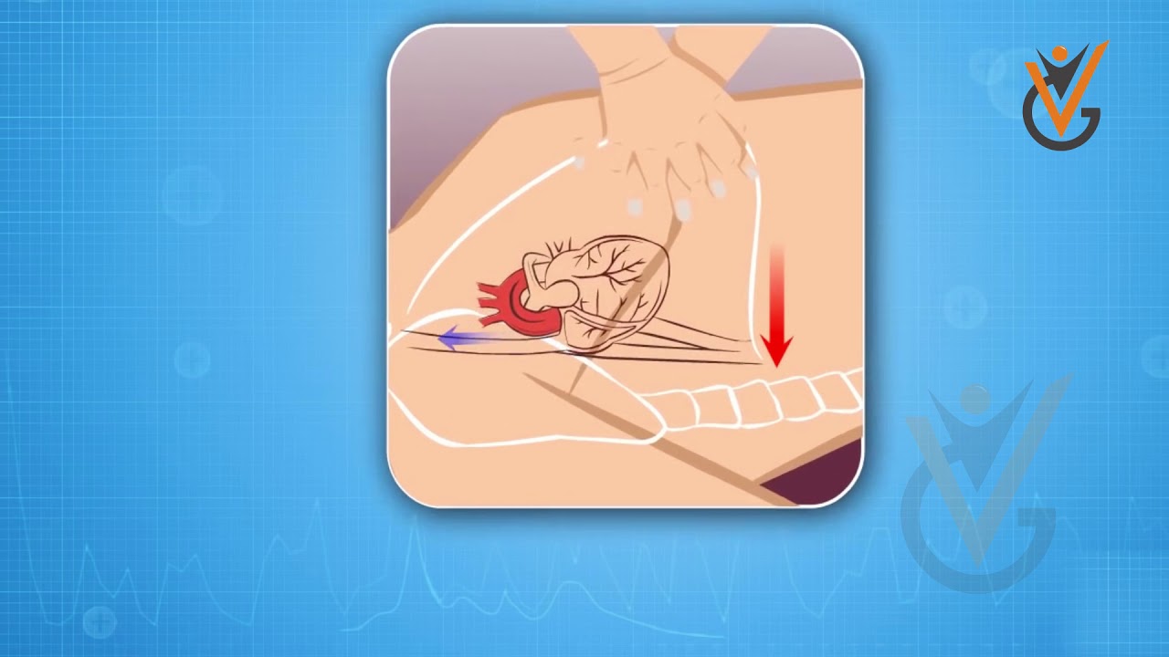 Cardiopulmonary Resuscitation (CPR) | EFA Course | Virtual Guru