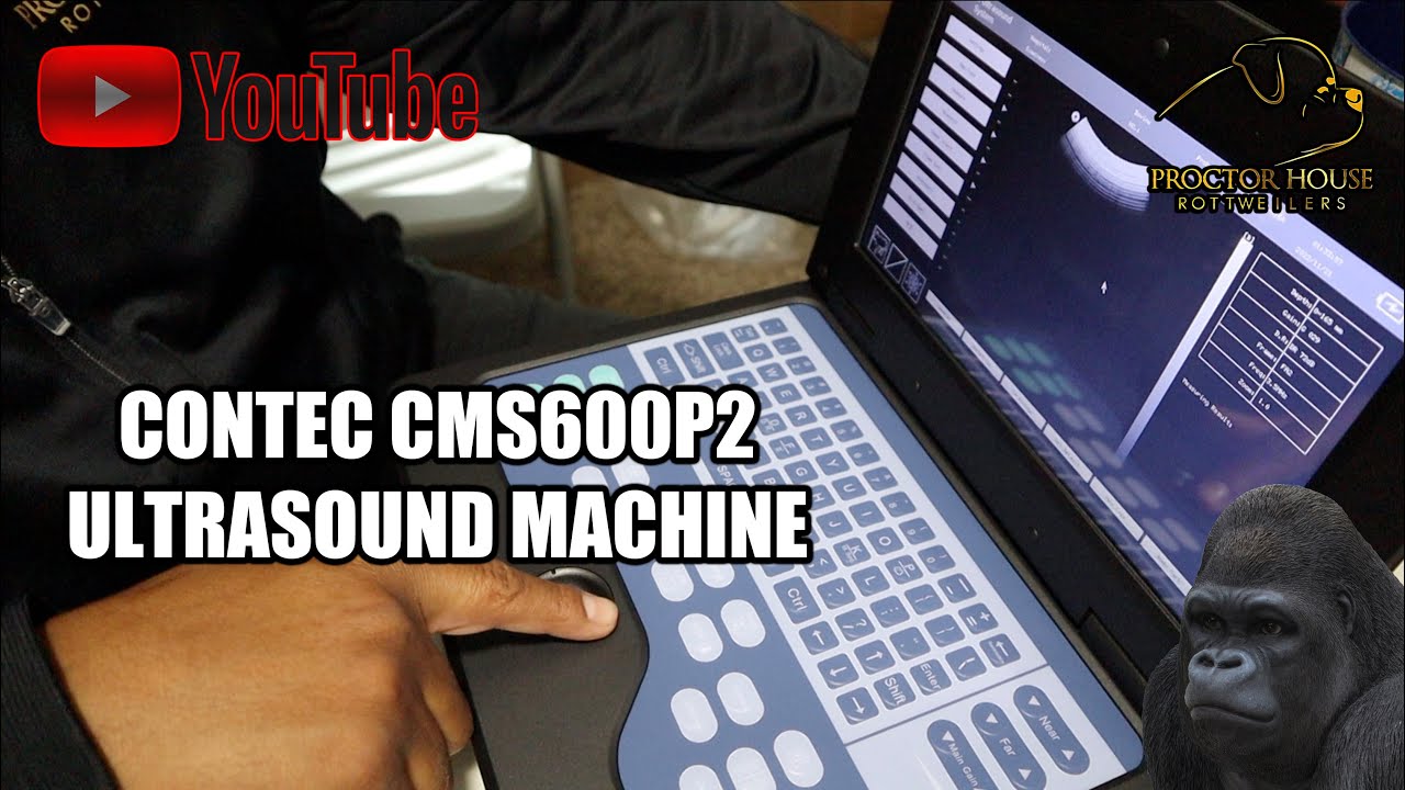 FIRST LOOK AT THE CONTEC CMS600P2 ULTRASOUND MACHINE
