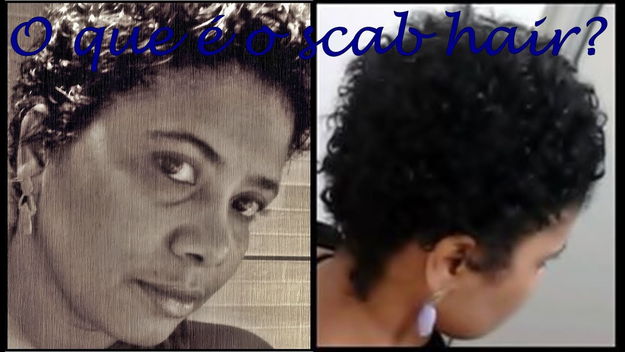 DESCUBRA O QUE &Eacute; SCAB HAIR