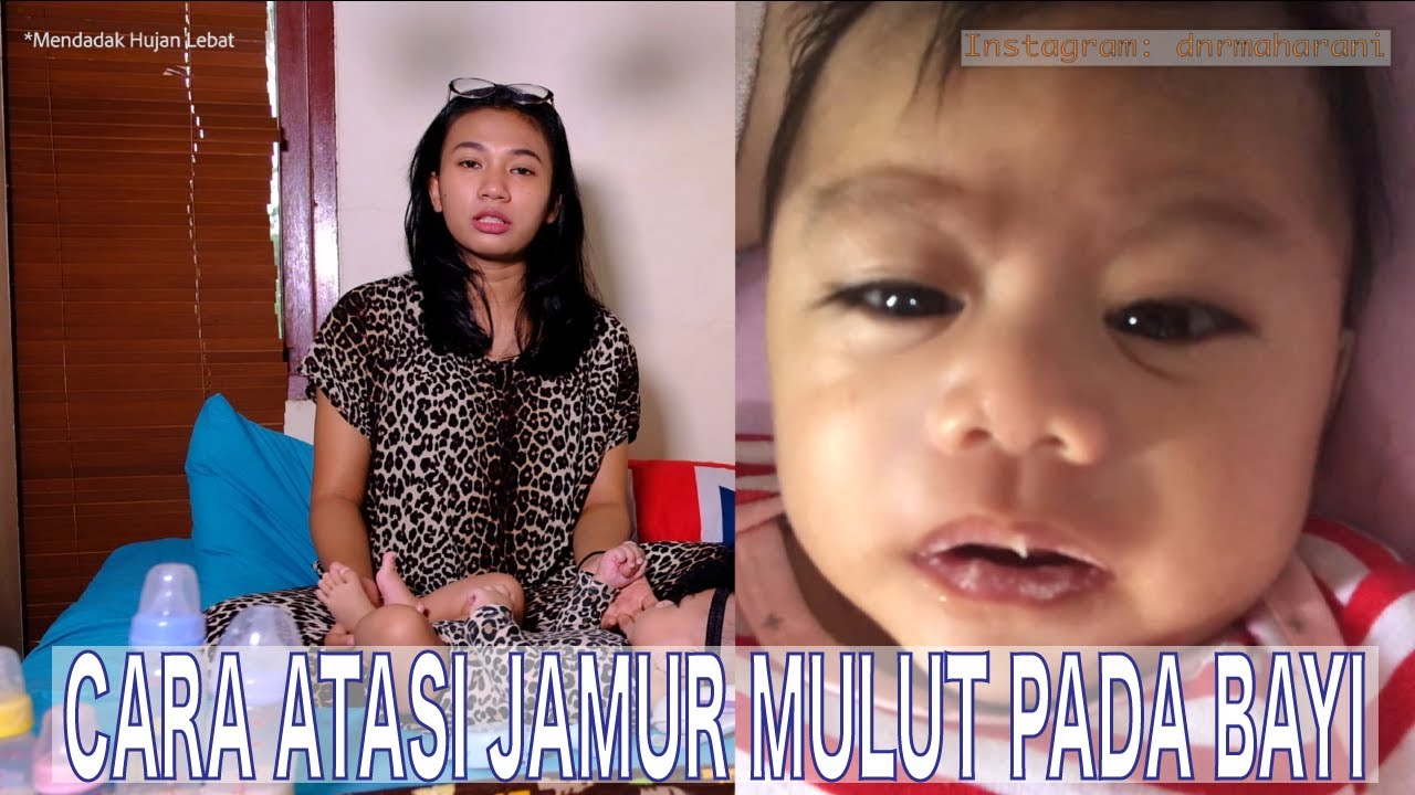 PENYEBAB JAMUR MULUT PADA BAYI DAN CARA AMPUH MENGOBATINYA | DINAR MAHARANI