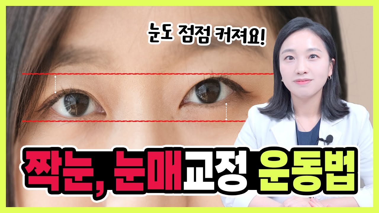 짝눈, 눈매교정 운동법 / 눈커지는 방법 / 눈비대칭 교정운동 / 또렷한 눈 만들기
