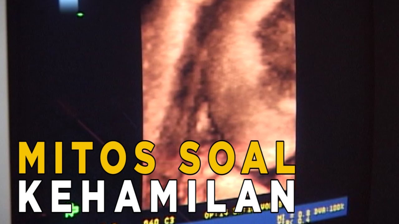 Beberapa mitos seputar hamil dan melahirkan | JELANG SIANG
