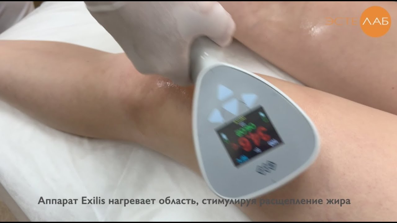 Коррекция фигуры на аппарате BTL Exilis