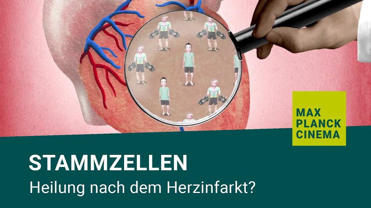 Stammzellen - Heilung nach dem Herzinfarkt?
