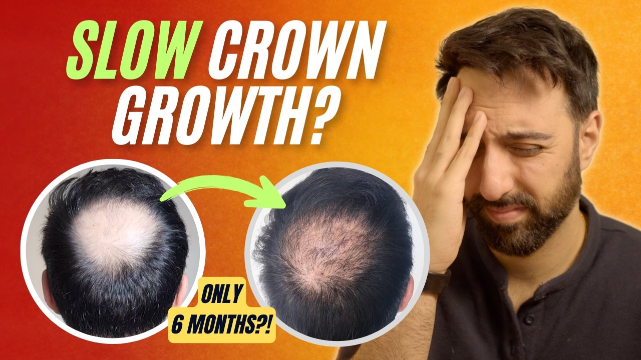 Crown Hair Not Growing? Here’s Why (and How to Speed It Up)