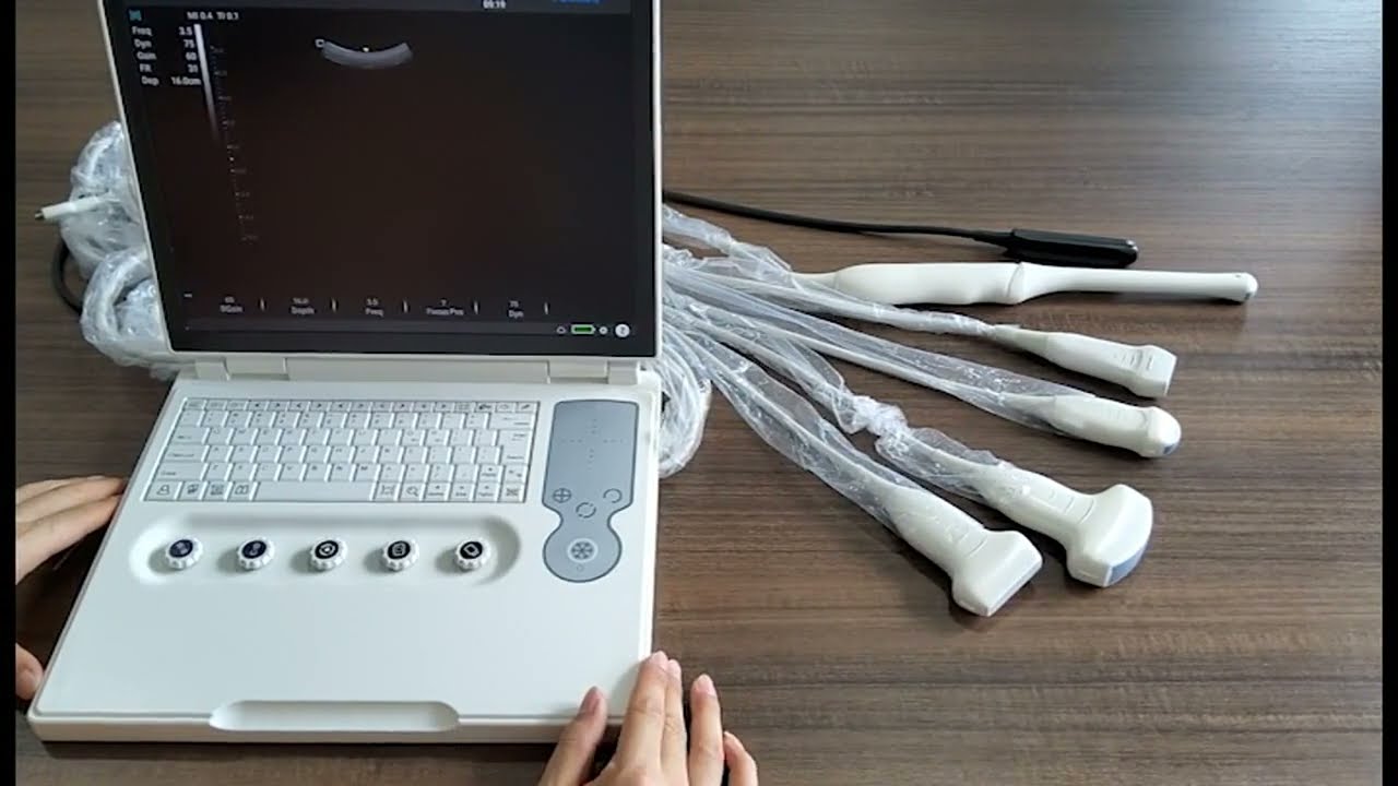 Youkey Portable Ultrasound-Episode 1-Youkey new portable ultrasound introduction