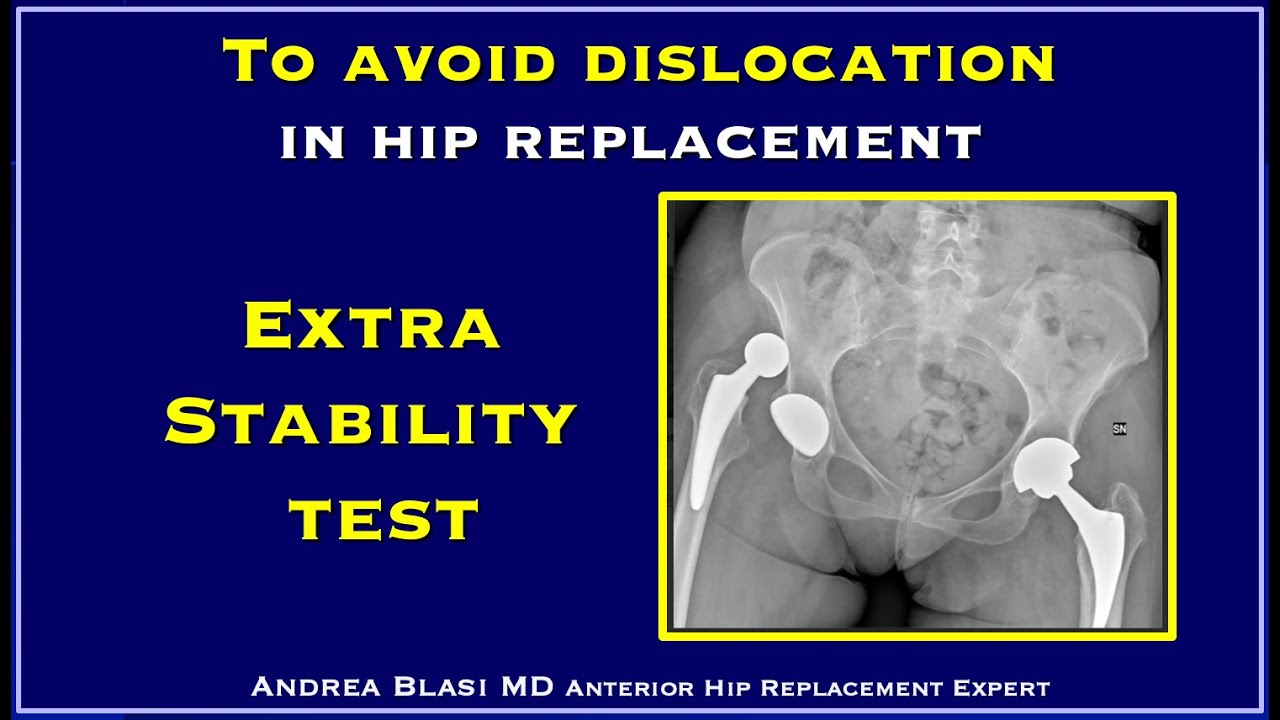 Extra stability test in hip replacement