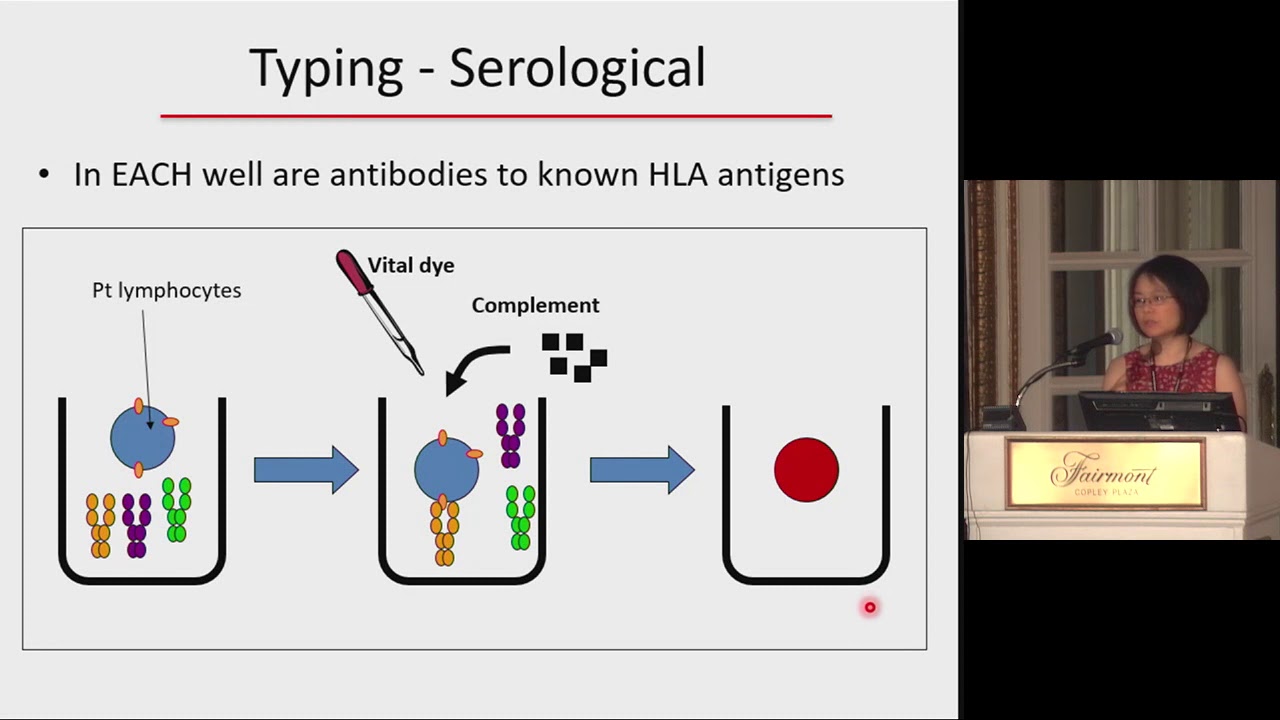 Brigham Renal Board Review, immunological assessment pre and post transplant