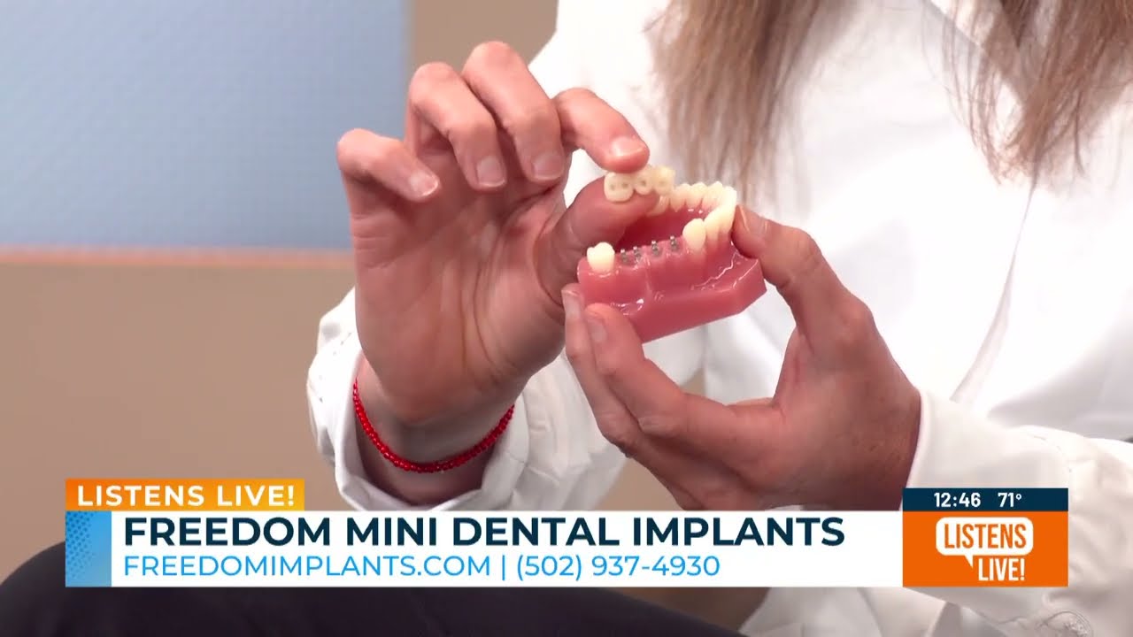 How Can Freedom Mini Dental Implants Help Me Smile Again? Dr. Ackerman Explains